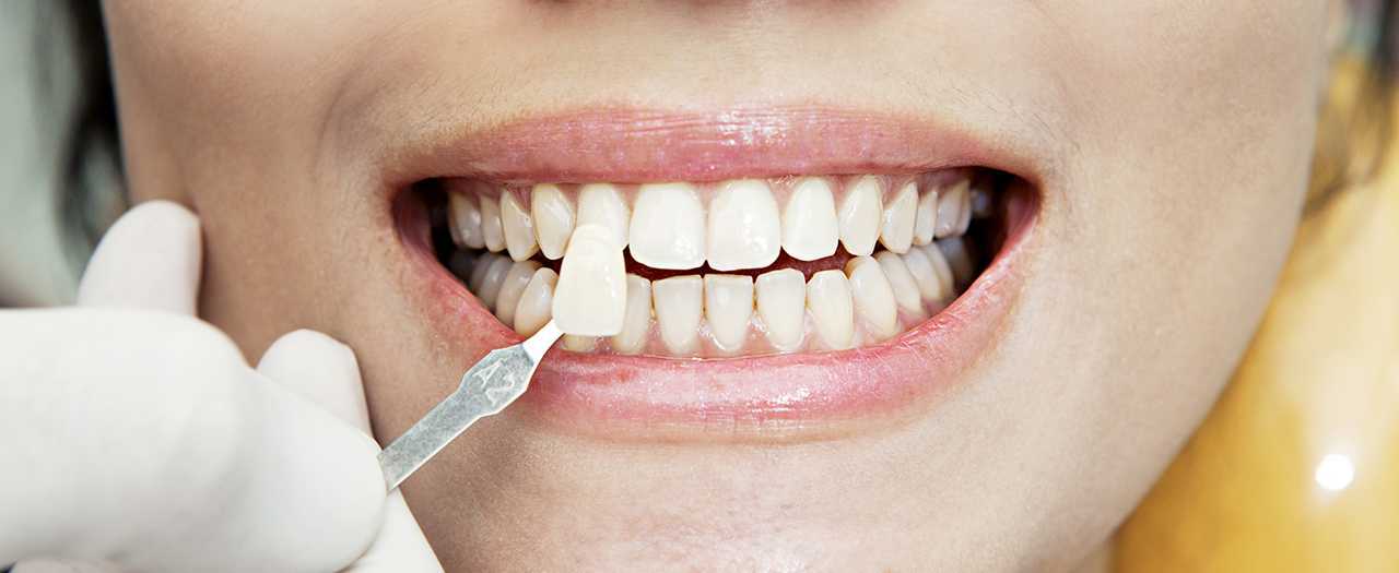 Уход за зубными протезами – чем чистить, как хранить ночью, средства