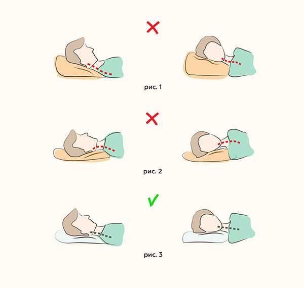 Как выбрать ортопедическую подушку (39 фото): как правильно подобрать взрослым модель по размеру для сна